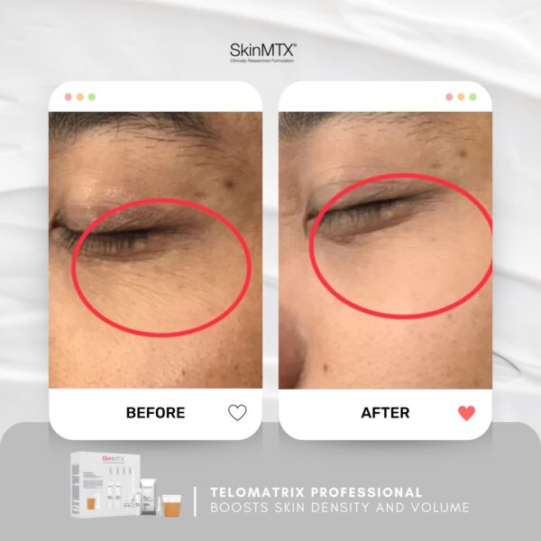TeloMatrix Professional – Giải Pháp Tái Sinh Làn Da Hoàn Hảo - Hình ảnh 4